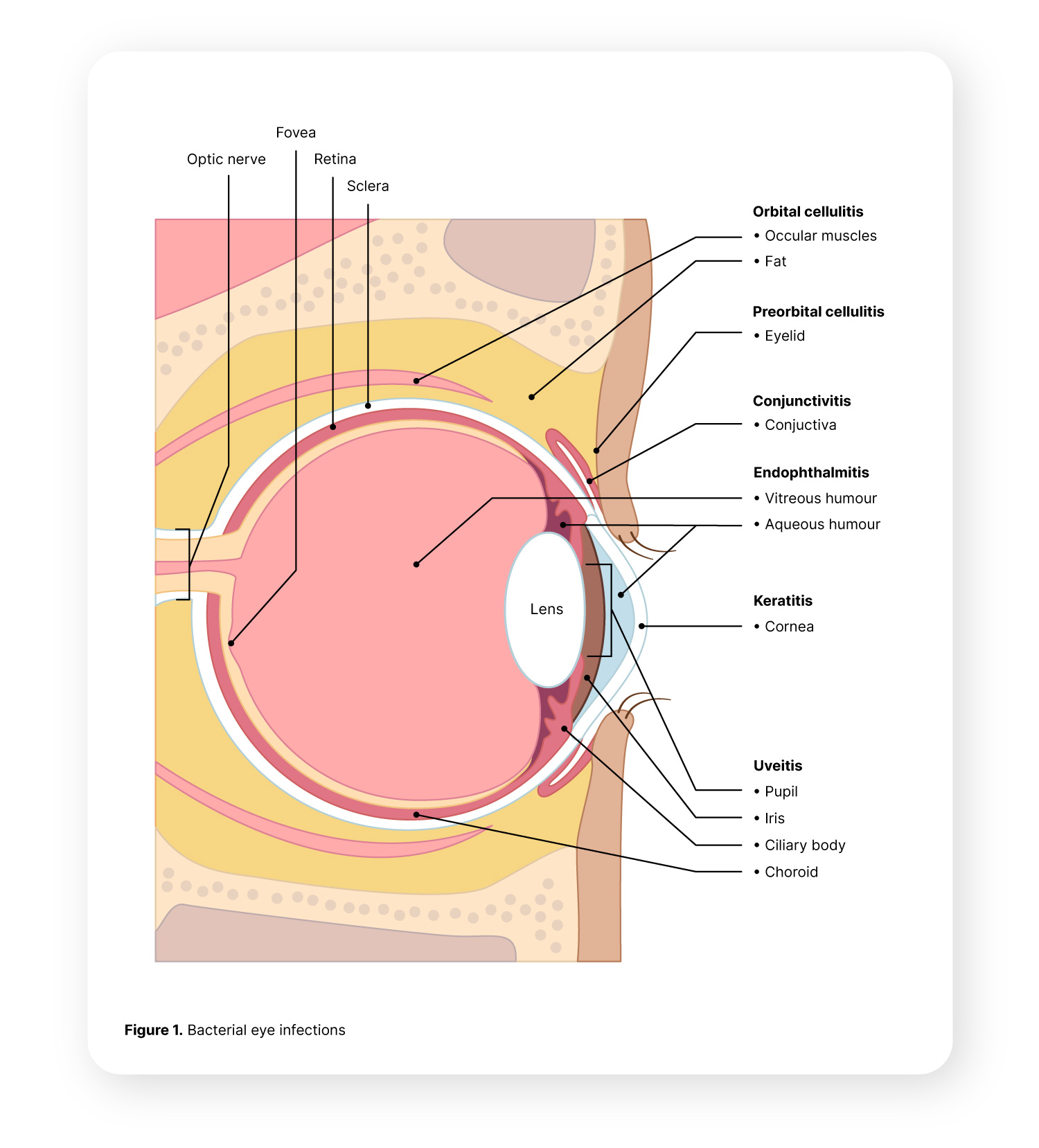 Eye infections